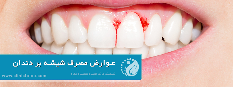 عوارض مصرف شیشه بر دندان